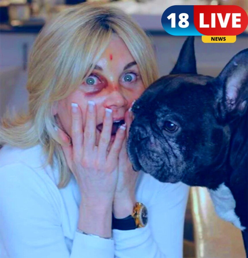 Anthea Turner Pyro accident