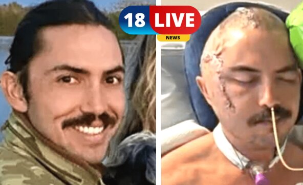 A Florida man, Juan Carlos La Verde: Survives Fight With 12 Foot Alligator